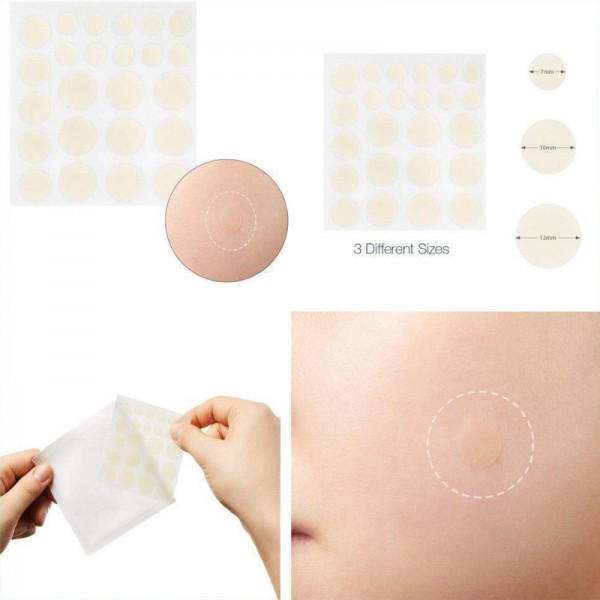 24pcs Face Acne Pimple Spot Scar Care Treatment Stickers Facial Skin Care Blackhead Removal Freckle Patches Acne Mask Beauty