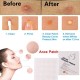 24pcs Face Acne Pimple Spot Scar Care Treatment Stickers Facial Skin Care Blackhead Removal Freckle Patches Acne Mask Beauty